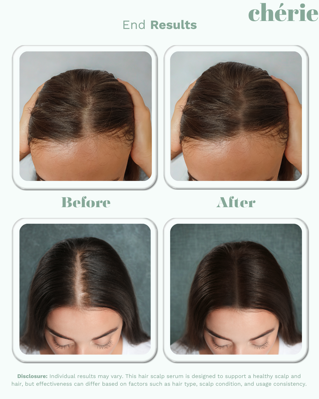 Revitalize Scalp Serum